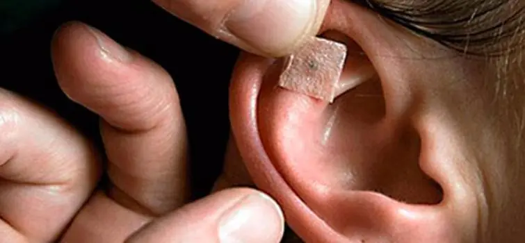 Universidade oferece sessões gratuitas de auriculoterapia e chi gong em Divinópolis