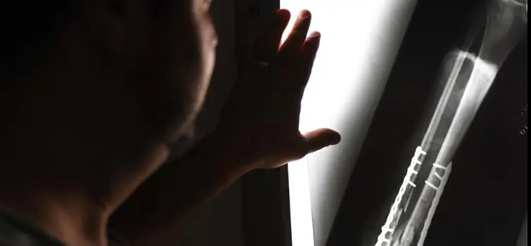 Município indenizará mulher que caiu em buraco em R$ 10 mil