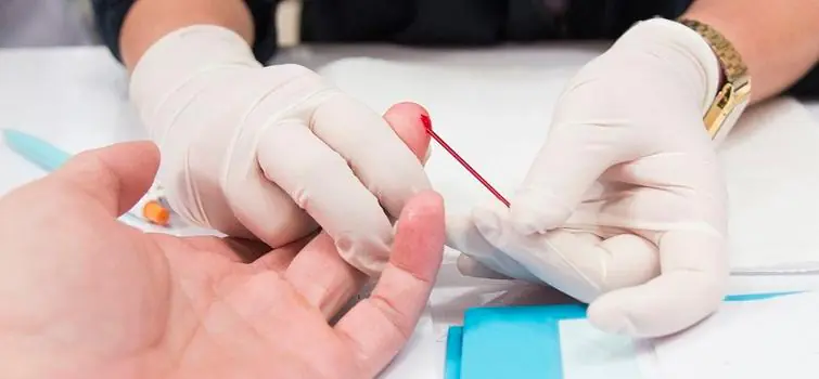 Sífilis: prevenção, diagnóstico e tratamento são oferecidos gratuitamente pelo SUS