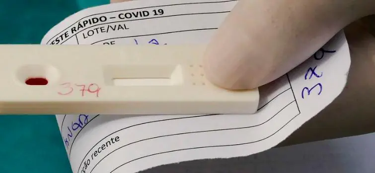 Saiba como fazer o teste diagnóstico de covid-19 pelo plano de saúde