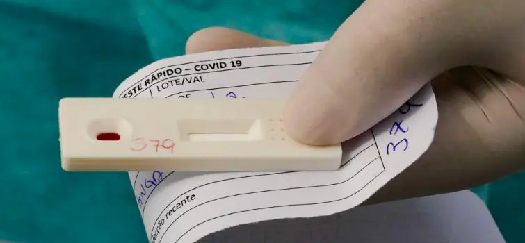 Três pontos de testagem para sintomas respiratórios são criados em Divinópolis