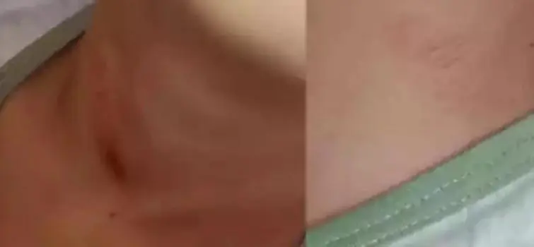 Mãe de criança agredida por dizer Lula lá depõe amanhã no MP