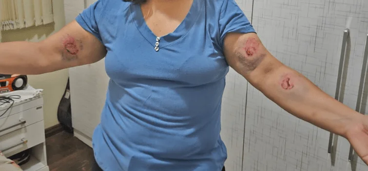 Professora 'salva' criança e é agredida por aluno no bairro Nações, em Divinópolis