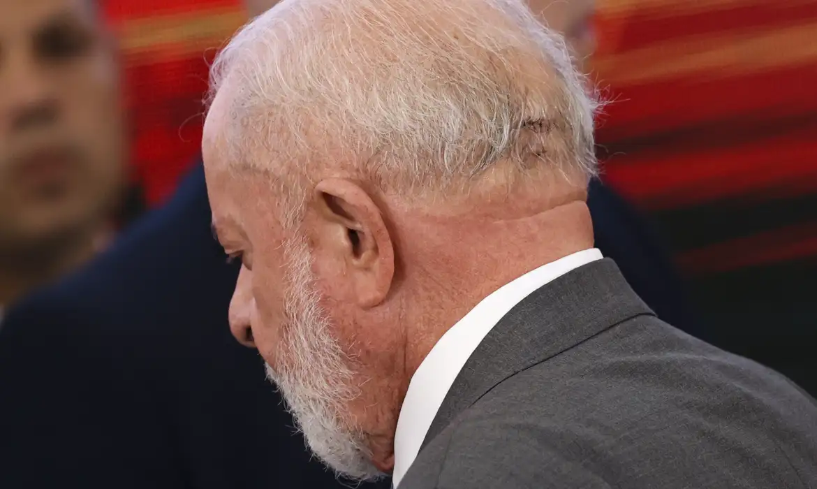 Lula passará por novo procedimento cirúrgico nesta quinta