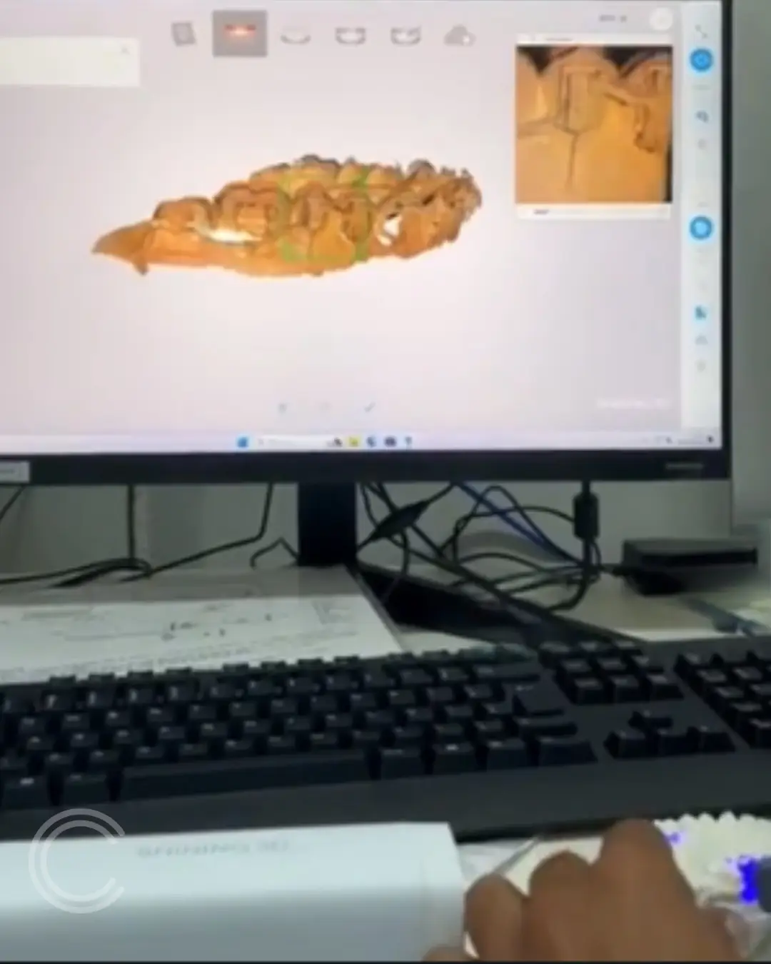 CSSJD inova com tecnologia de ponta, sendo a primeira unidade a atender ao SUS em MG a utilizar Scanner Intraoral e Impressora 3D para tratamentos odontológicos