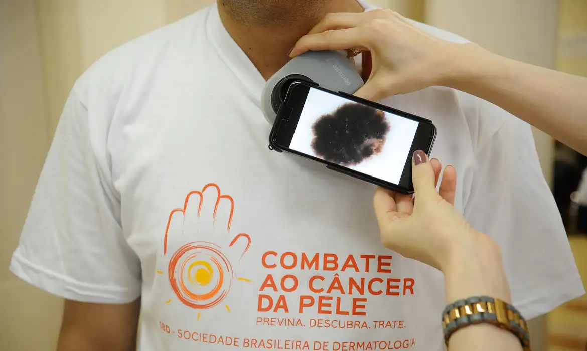Câncer já mata mais que doenças do coração em algumas cidades da região