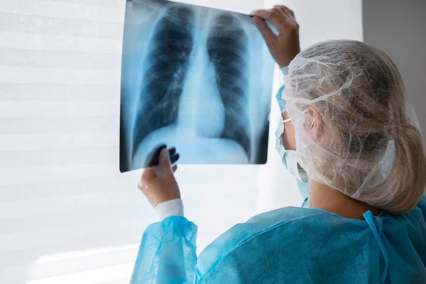 Divinópolis registra, em 2025, o maior número de casos de tuberculose dos últimos 10 anos
